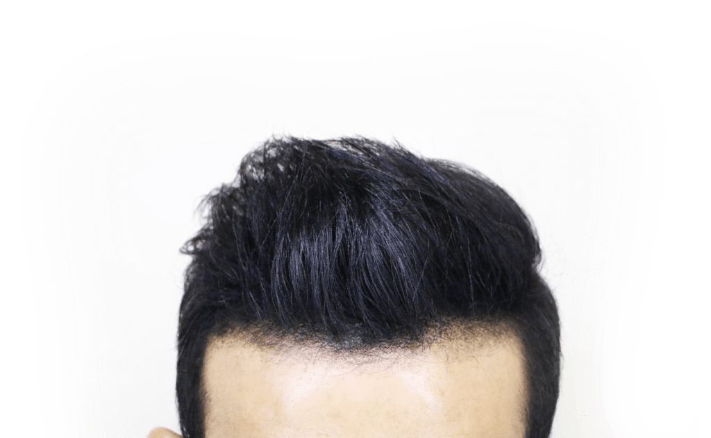 After